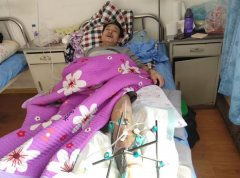 <b>白山市江源区财源煤矿借钱给出事矿工救治却不让其打官司?</b>